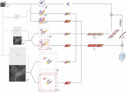 UDT: U-shaped deformable transformer for subarachnoid haemorrhage image segmentation