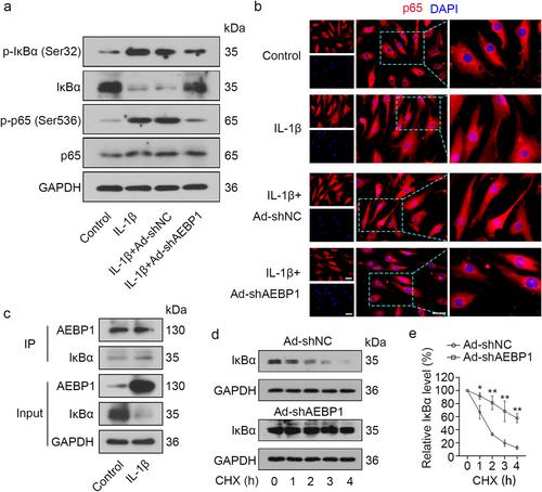 Adipocyte enhancer binding protein 1 knockdown alleviates osteoarthritis through inhibiting NF-κB signaling pathway-mediated inflammation and extracellular matrix degradation