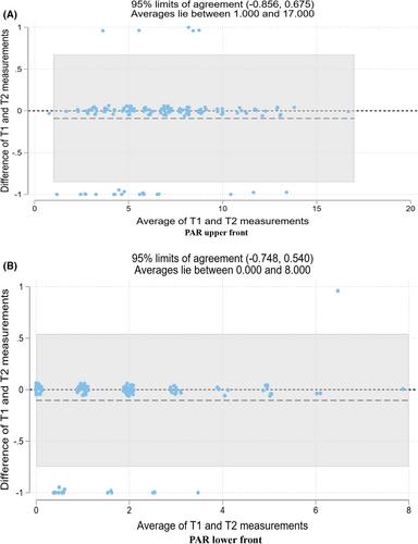 Mandibular second molar extraction: A retrospective cohort study of spontaneous occlusal changes in adolescent patients