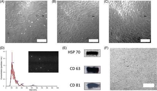 Mesenchymal stem cell-secretome laden photopolymerizable hydrogels for wound healing