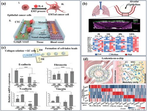 Cancer-on-Chip and Integrative Tumor Microenvironment Sensor Technologies for Progressing Precision Radiotherapy