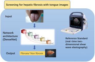 Exploring hepatic fibrosis screening via deep learning analysis of tongue images