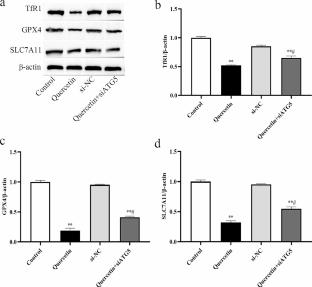 Quercetin promotes ATG5-mediating autophagy-dependent ferroptosis in gastric cancer