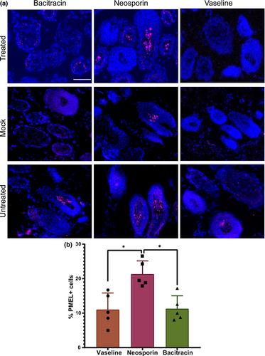 Topical antibiotics limit depigmentation in a mouse model of vitiligo