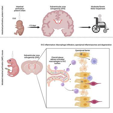 Subventricular zone stem cell niche injury is associated with intestinal perforation in preterm infants and predicts future motor impairment.