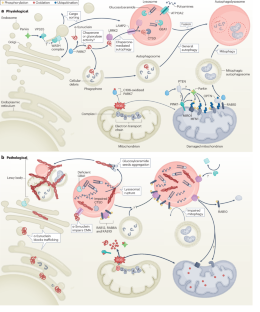 Key genes and convergent pathogenic mechanisms in Parkinson disease