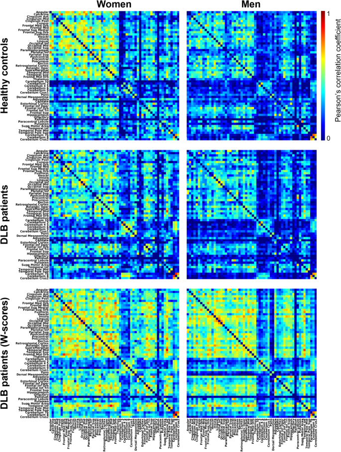 Grey matter networks in women and men with dementia with Lewy bodies