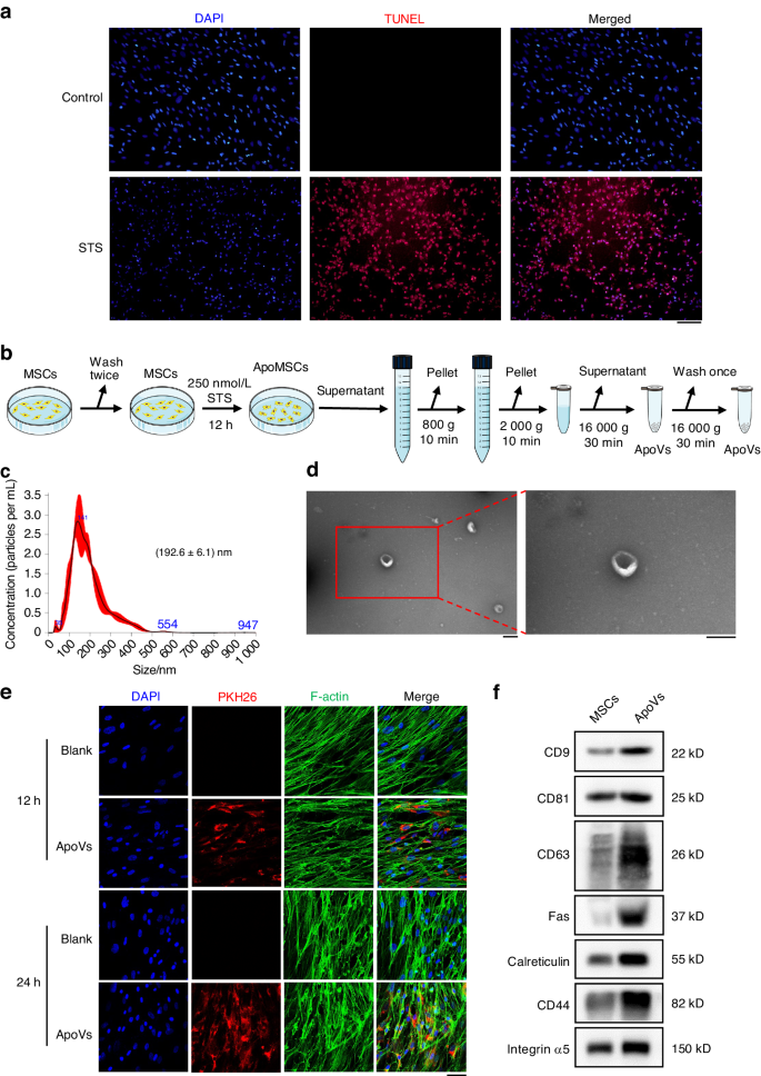 Tailored apoptotic vesicles promote bone regeneration by releasing the osteoinductive brake