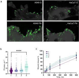 Effect of Focal Adhesion Kinase and Vinculin Expression on Migration Parameters of Normal and Tumor Epitheliocytes