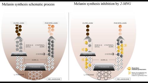 2-Mercaptonicotinoyl glycine, a new potent melanogenesis inhibitor, exhibits a unique mode of action while preserving melanocyte integrity