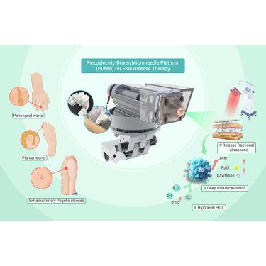 A piezoelectric-driven microneedle platform for skin disease therapy