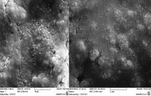 Antibacterial Synergy: Assessing the Impact of Nano Zirconium Oxide Particles in Combination with Selected Antibiotics on Escherichia coli and Klebsiella pneumoniae Isolates from Urinary Tract Infections