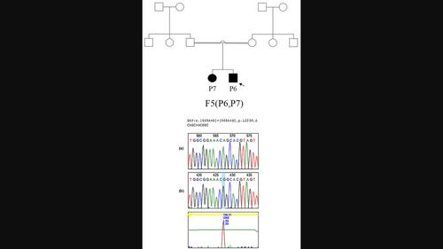 Genetic analysis of nephrogenic diabetes insipidus patients: A study on the Iranian population