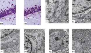 A Study of Neurodegenerative Changes in the CA1 Region of the Dorsal Hippocampus in Adult Rats with Prenatal Hyperhomocysteinemia