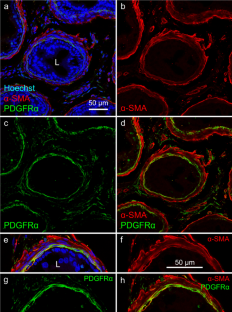 Involvement of ANO1 currents in pacemaking of PDGFRα-positive specialised smooth muscle cells in rat caudal epididymis