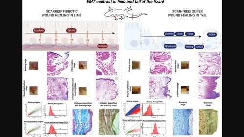 Epithelial–mesenchymal transition contrast in the amputated tail and limb of the northern house gecko, Hemidactylus flaviviridis