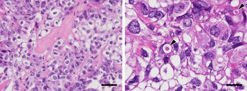 Establishment of a human ovarian clear cell carcinoma cell line mutant in PIK3CB but not PIK3CA