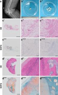 CD34+ synovial fibroblasts exhibit high osteogenic potential in synovial chondromatosis