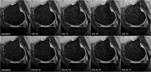 Reconstruction of 3D knee MRI using deep learning and compressed sensing: a validation study on healthy volunteers