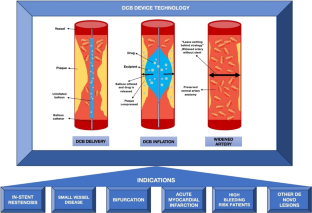 Drug-Coated Balloon in Acute Coronary Syndromes: Ready for the Prime Time?