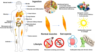 Advances in sarcopenia: mechanisms, therapeutic targets, and intervention strategies