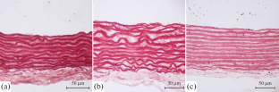 Structural Features of the Wall of the Ascending Aorta of Premature Rats