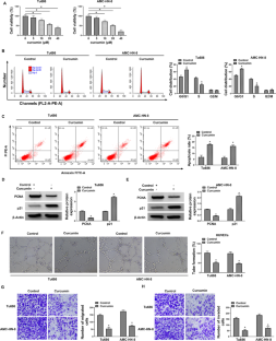 Curcumin suppresses the malignant phenotype of laryngeal squamous cell carcinoma through downregulating E2F1 to inhibit FLNA