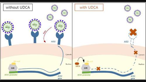 Ursodeoxycholic acid may protect from severe acute respiratory syndrome coronavirus 2 Omicron variant by reducing angiotensin‐converting enzyme 2