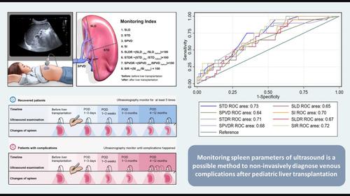 A new method to predict venous complications in pediatric liver transplantation: Evaluation of splenic parameters by ultrasonography