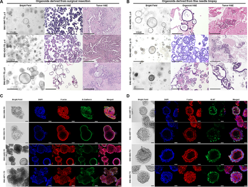 Establishment, characterization, and biobanking of 36 pancreatic cancer organoids: prediction of metastasis in resectable pancreatic cancer