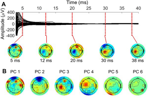 Adapted Beamforming: A Robust and Flexible Approach for Removing Various Types of Artifacts from TMS–EEG Data