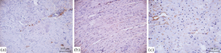 An Immunohistochemical Study of Matrix Metalloproteinase 2 and 9 in the Left Ventricle of the Heart of Preterm Born Rats in the Late Period of Ontogenesis