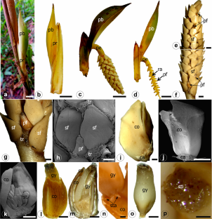 Anatomy and ontogeny of inflorescence and flower of Bactris simplicifrons Mart. (Arecaceae, Arecoideae, Bactridinae)