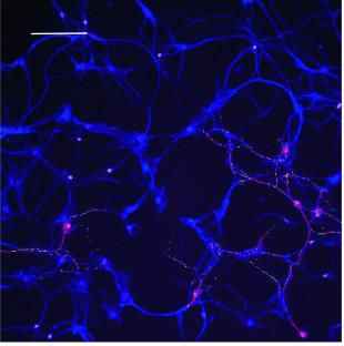 Knockdown siRNA Targeting GPR55 Reveals Significant Differences Between the Anti-inflammatory Actions of KLS-13019 and Cannabidiol