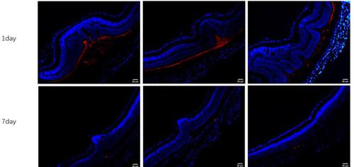 Selective microRNA expression of exosomes from retinal pigment epithelial cells by oxidative stress