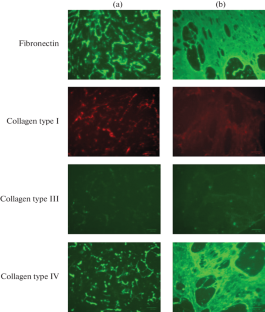 Decellularized Extracellular Matrix Slows Down Premature Senescence of Human Endometrial Mesenchymal Stromal Cells