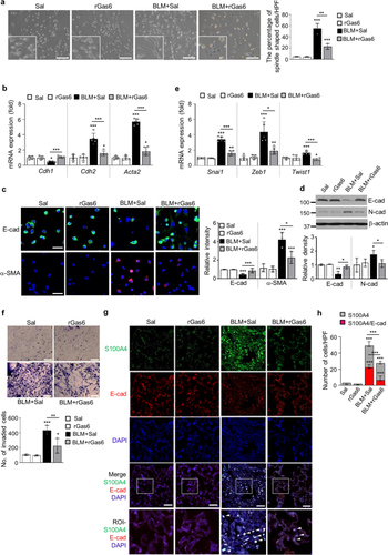 Administration of Gas6 attenuates lung fibrosis via inhibition of the epithelial-mesenchymal transition and fibroblast activation