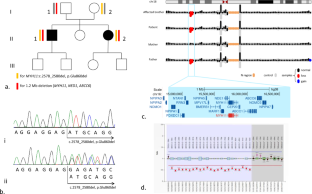 Genome-wide analysis identifies MYH11 compound heterozygous variants leading to visceral myopathy corresponding to late-onset form of megacystis-microcolon-intestinal hypoperistalsis syndrome