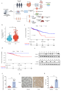 Dexmedetomidine promotes colorectal cancer progression via Piwil2 signaling