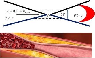 Mechanics of blood flow through narrow artery using Prandtl viscoelastic model