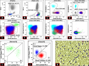 Bi-clonal Chronic Lymphocytic Leukemia