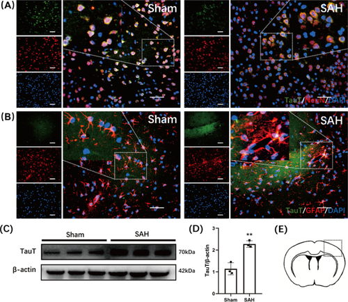 Taurine ameliorates sensorimotor function by inhibiting apoptosis and activating A2 astrocytes in mice after subarachnoid hemorrhage