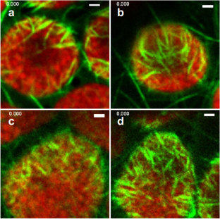 Chloroplast-actin filaments decide the direction of chloroplast avoidance movement under strong light in Arabidopsis thaliana