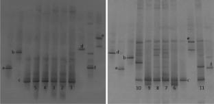 Analysis of the bacterial diversity in Moroccan Jben cheese using TTGE, DGGE, and 16S rRNA sequencing