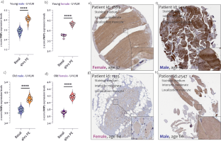 Skeletal muscle of young females under resistance exercise exhibits a unique innate immune cell infiltration profile compared to males and elderly individuals