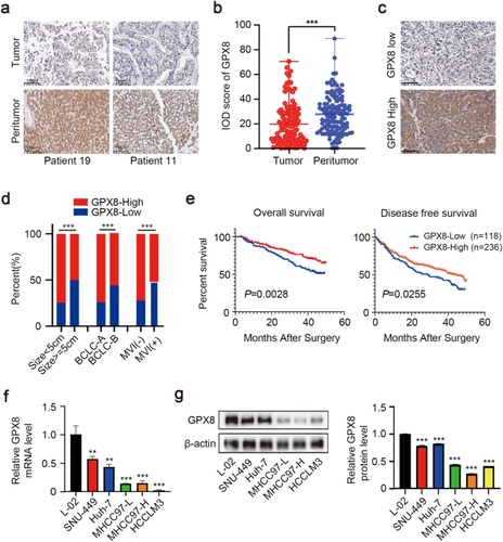 Downregulation of GPX8 in hepatocellular carcinoma: impact on tumor stemness and migration