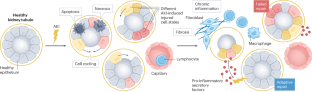 Epithelial cell states associated with kidney and allograft injury