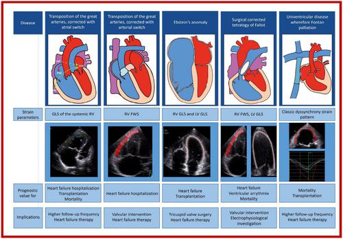 Prognostic significance of echocardiographic deformation imaging in adult congenital heart disease