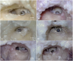 Hampshire Sheep as a Large-Animal Model for Cochlear Implantation