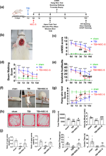 Human neural stem cell secretome relieves endoplasmic reticulum stress-induced apoptosis and improves neuronal functions after traumatic brain injury in a rat model